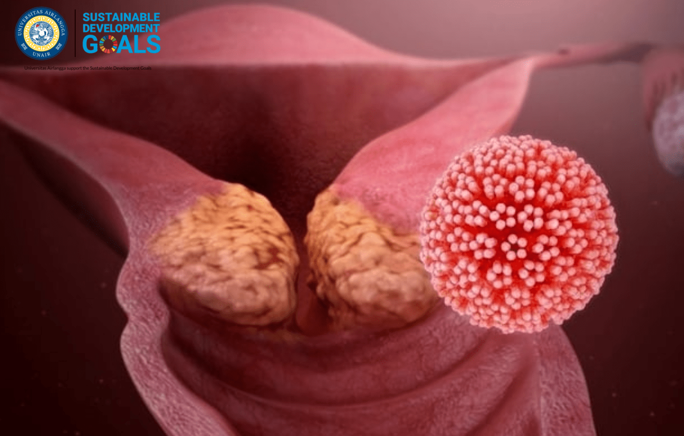 Kanker Serviks: Masih Menjadi Ancaman Besar bagi Perempuan Indonesia